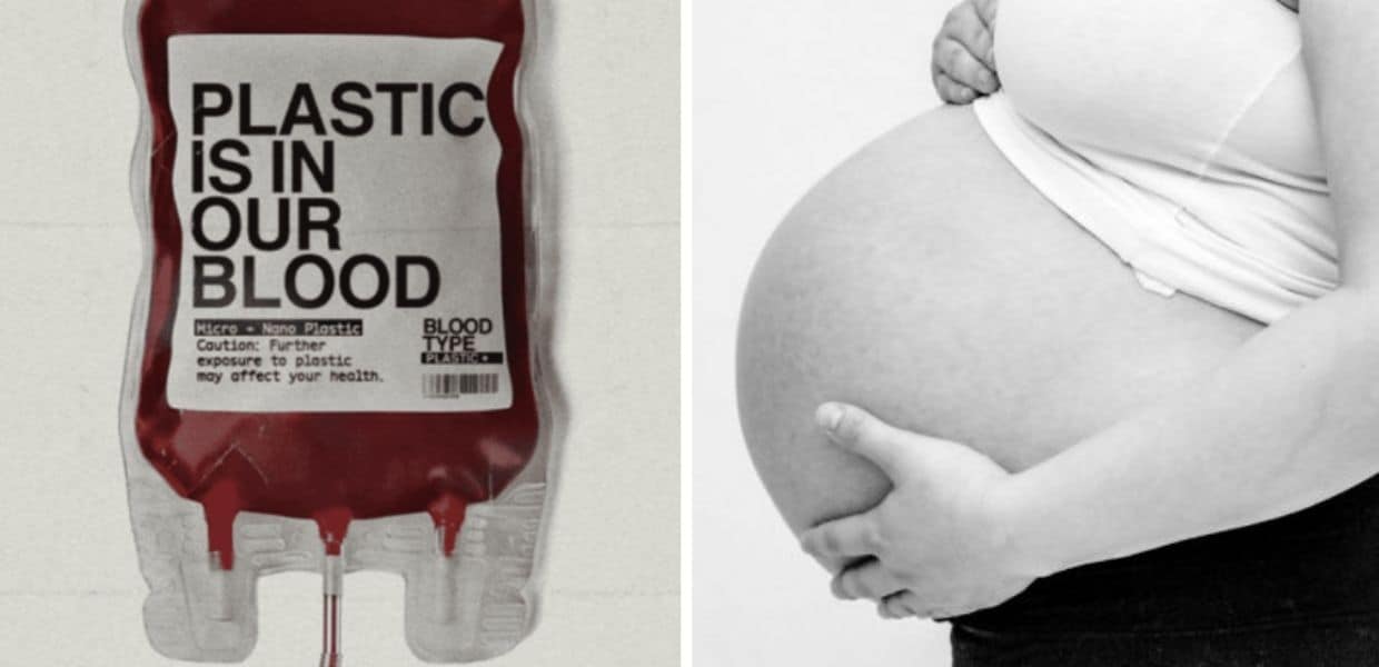 microplastiche placenta sangue polmoni