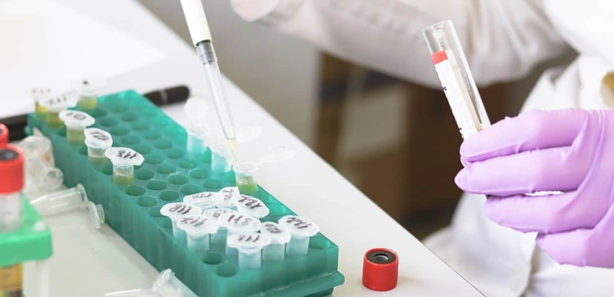 Microplastiche, trovate per la prima volta anche nelle urine. Lo studio italiano indaga sui rischi