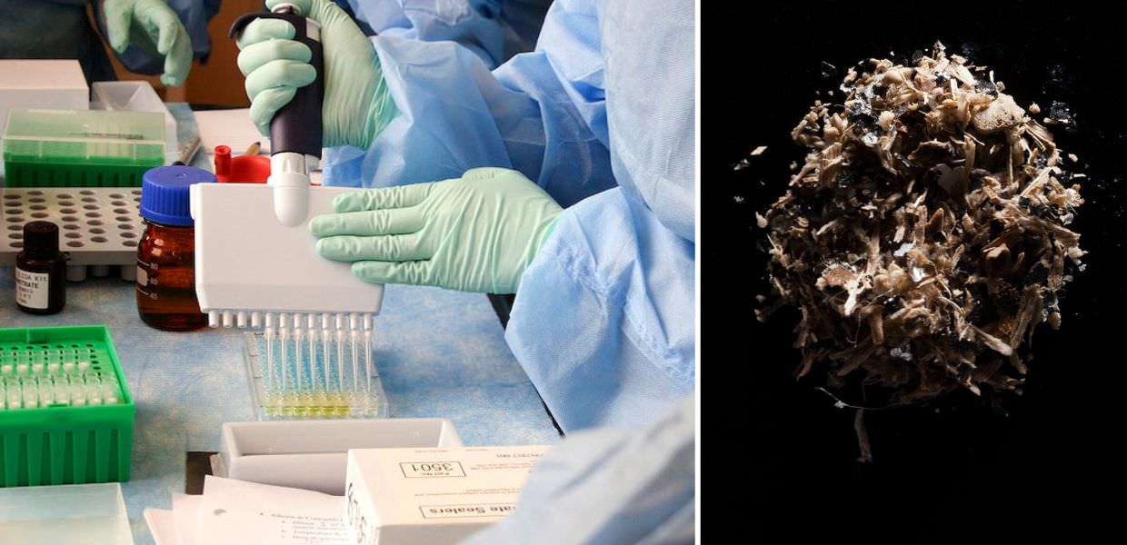 microplastiche sperma