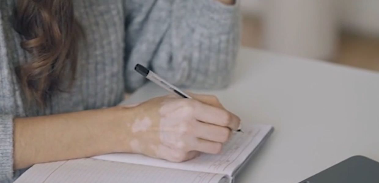 Vitiligine, Ema approva nuovo farmaco antinfiammatorio