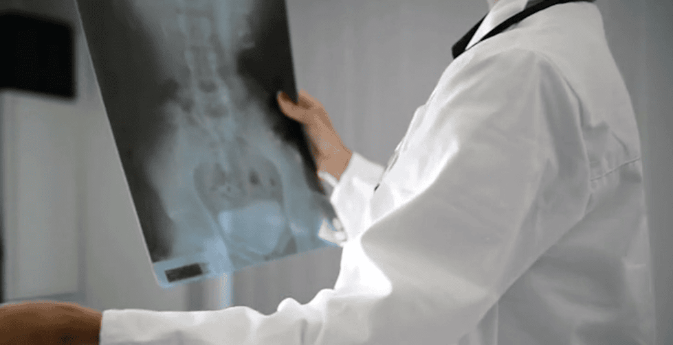 tumore vescica farmaco