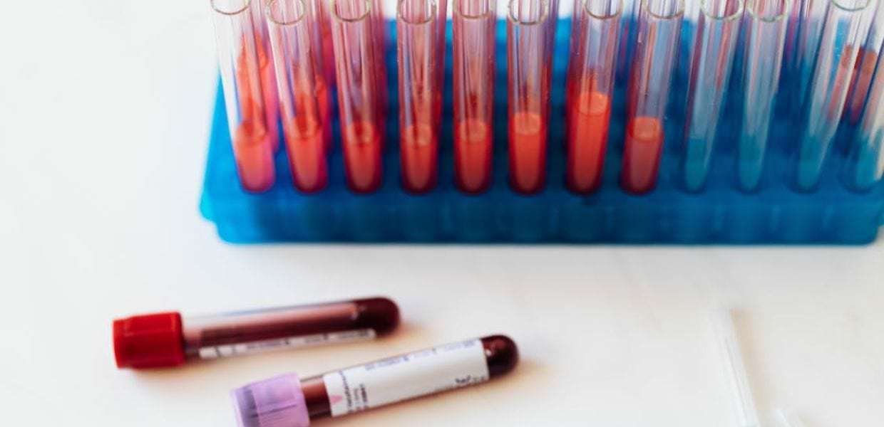 pfas contaminazione sangue leader ue