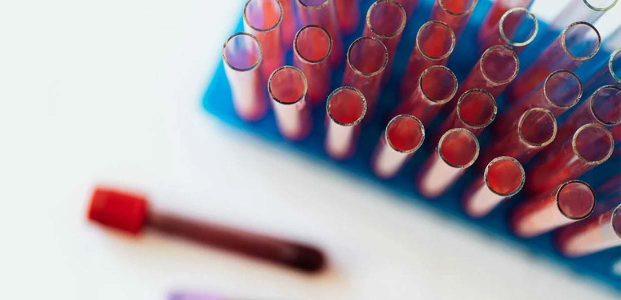 Alcuni cibi aumentano i livelli di PFAS nel sangue, ecco quali sono