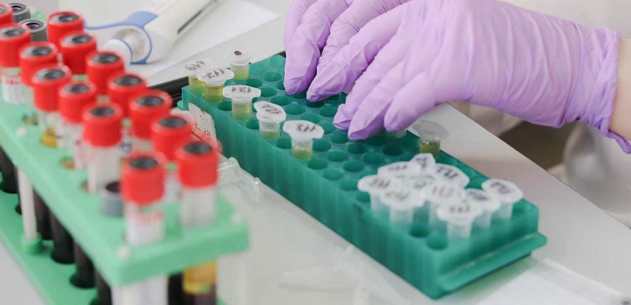 Microplastiche nei testicoli di umani e cani, potrebbero incidere sulla fertilità