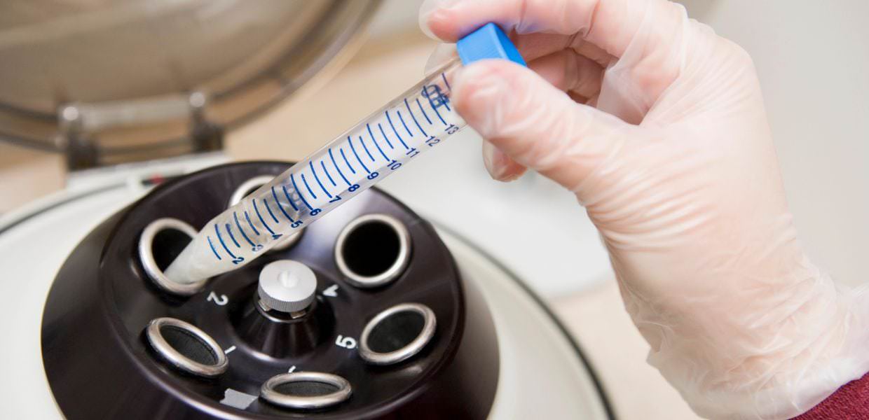 Microplastiche nello sperma, un nuovo studio le trova nel 100% dei campioni