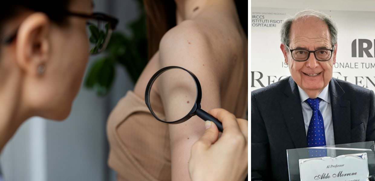 roma open day diagnosi tumori pelle