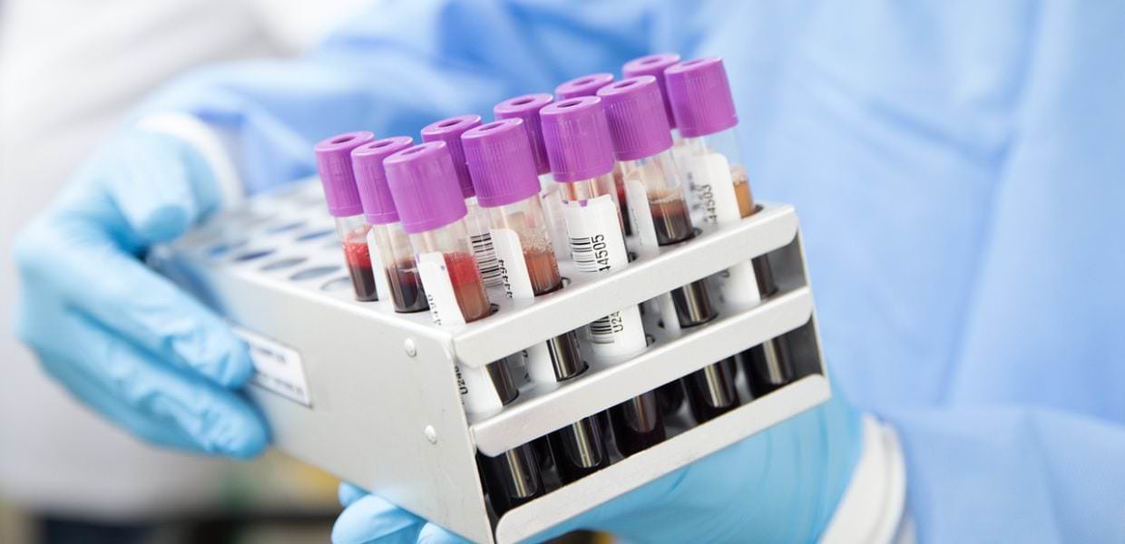 Da una ricerca italiana un metodo per rimuovere i PFAS dal sangue