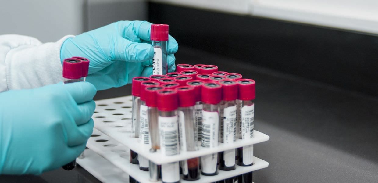 PFAS, biomonitoraggio di Greenpeace ad Alessandria valori oltre i limiti di sicurezza