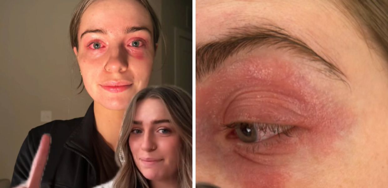 shein orecchini denuncia