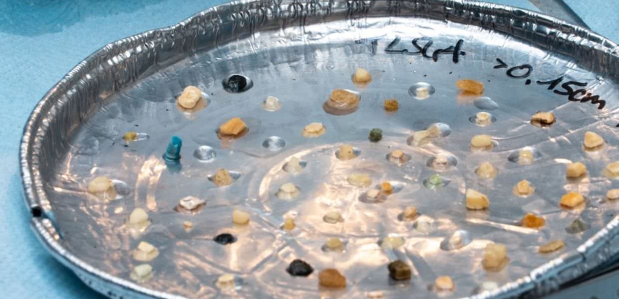 Microplastiche, nella Great Pacific Garbage Patch aumentano sempre di più. L’allarme di The Ocean Cleanup Campione di microplastiche raccolte dalla Great Pacific Garbage Patch, evidenziando l'aumento allarmante della contaminazione marina.