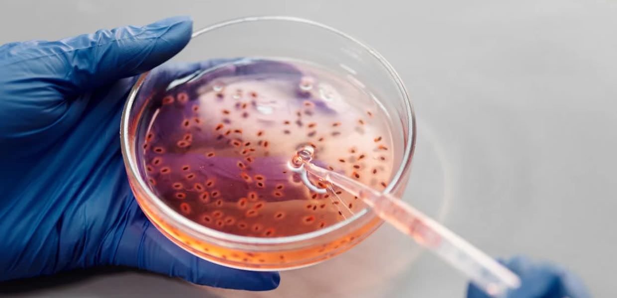 Alcuni batteri sono in grado di scomporre i PFAS Campione di batteri in laboratorio, capace di scomporre PFAS, in una piastra di Petri con guanti blu.