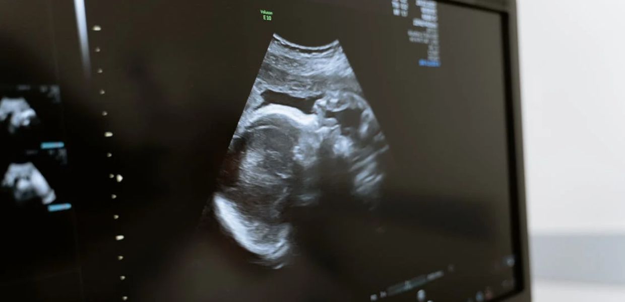 PFAS, uno studio li collega al rischio di aborti spontanei