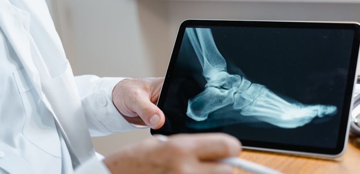 Le microplastiche possono causare danni alle ossa. Lo studio