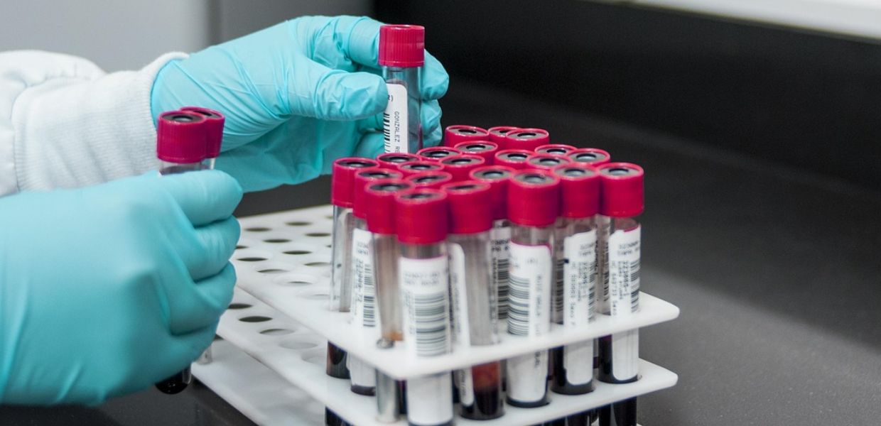 PFAS e gravidanza, l'esposizione neonatale è più alta del previsto. Lo studio